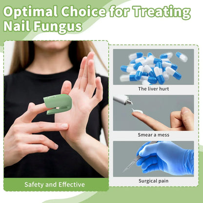 Nail Fungus Cleaning Device - QayyoomLux